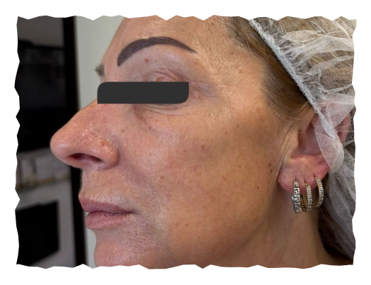 posle-slika-labelage-solutions