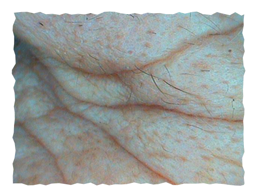 posle-slika-labelage-solutions